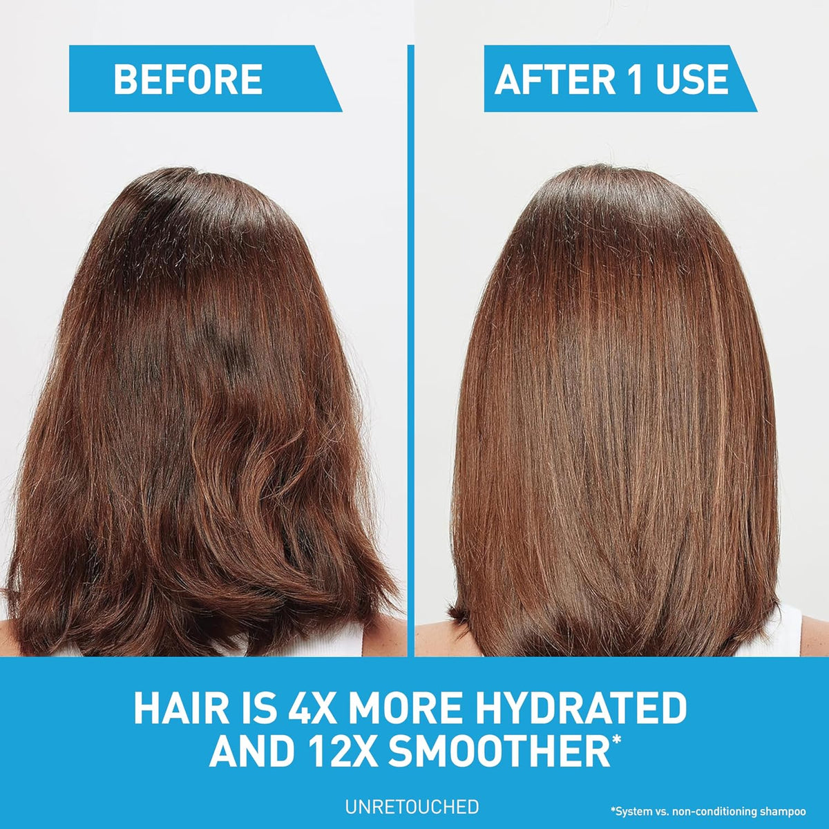 CeraVe Hydrating Anti Dandruff Shampoo. Itchy Scalp Treatment. 12oz | Helps Eliminate Flakes with 1% Pyrithione Zinc. Hyaluronic Acid. Niacinamide and Ceramides In Sulfate Free Formula